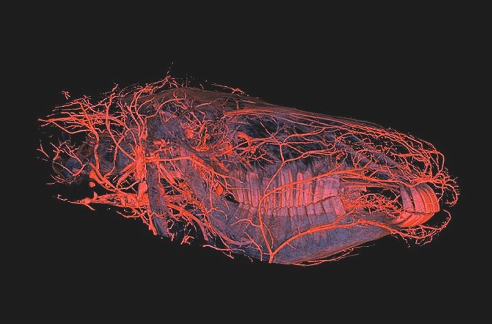 What Are Spider-Like Little Blood Vessels?